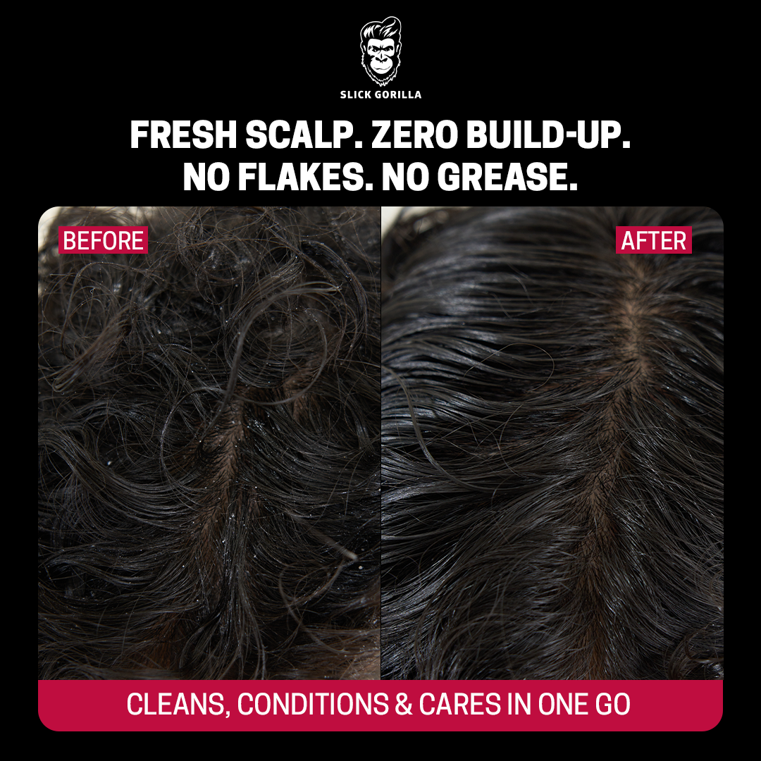 Scalp Scrub