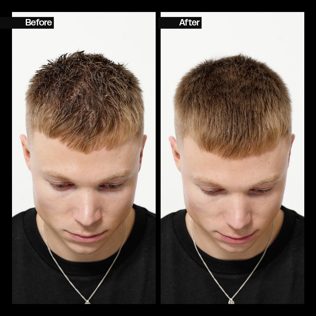 Slick Gorilla US Scalp Scrub